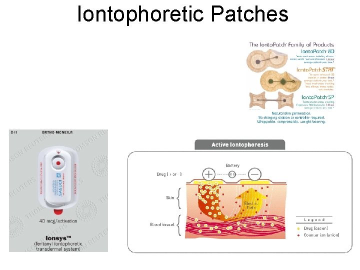 Iontophoretic Patches 