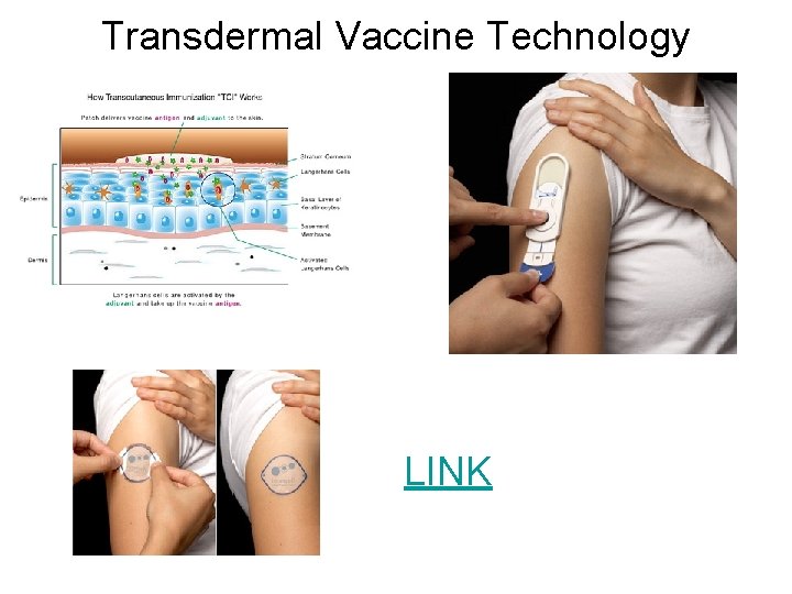 Transdermal Vaccine Technology LINK 