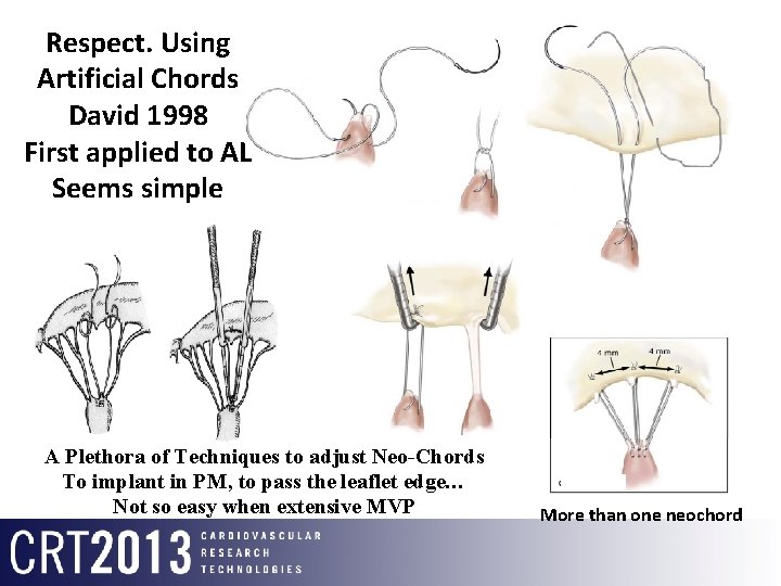 Respect. Using Artificial Chords David 1998 First applied to AL Seems simple A Plethora