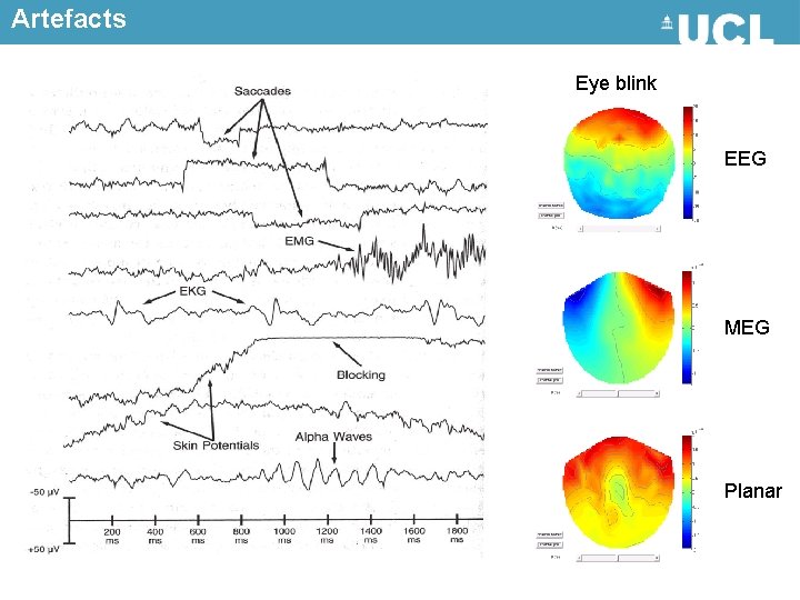 Artefacts Eye blink EEG MEG Planar 