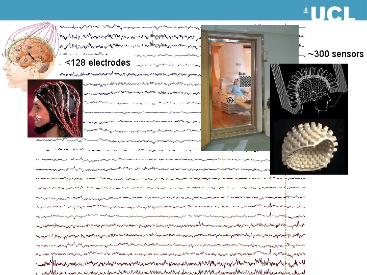 <128 electrodes ~300 sensors 