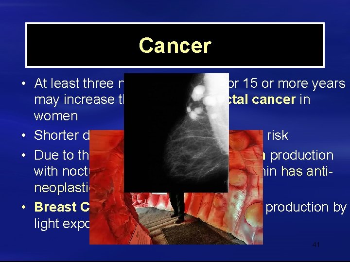 Cancer • At least three nights per month for 15 or more years may