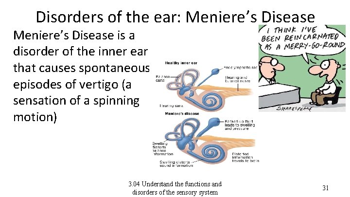 Disorders of the ear: Meniere’s Disease is a disorder of the inner ear that