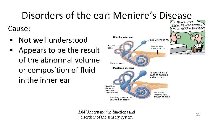 Disorders of the ear: Meniere’s Disease Cause: • Not well understood • Appears to