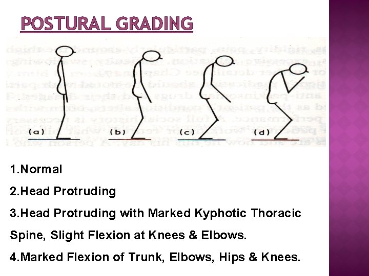 POSTURAL GRADING 1. Normal 2. Head Protruding 3. Head Protruding with Marked Kyphotic Thoracic