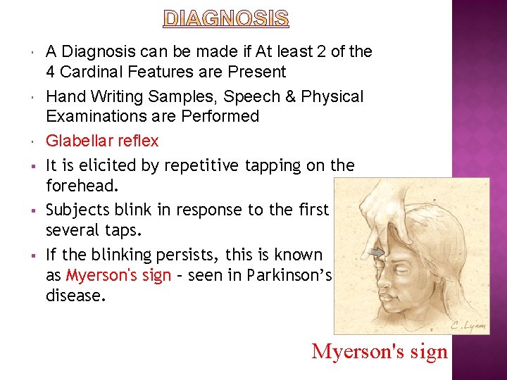  § § § A Diagnosis can be made if At least 2 of