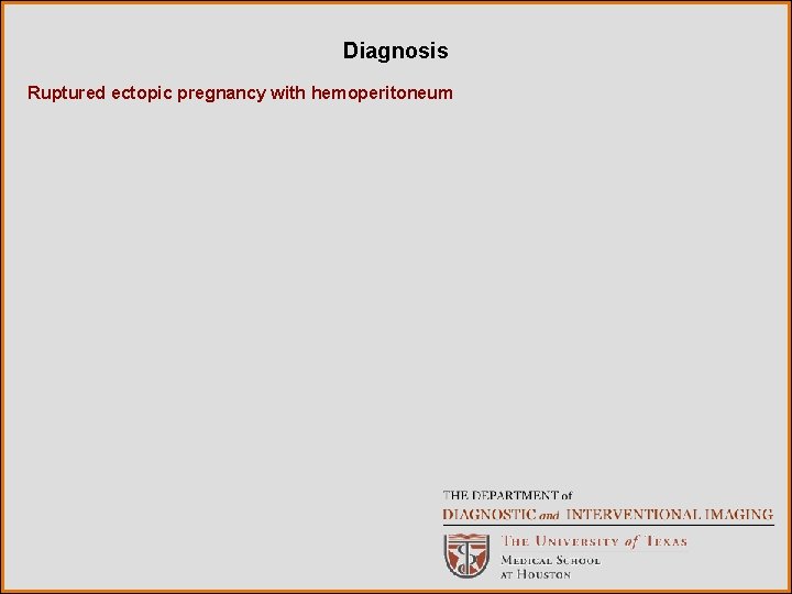 Diagnosis Ruptured ectopic pregnancy with hemoperitoneum 