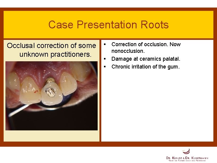 Case Presentation Roots Occlusal correction of some unknown practitioners. § § § Correction of