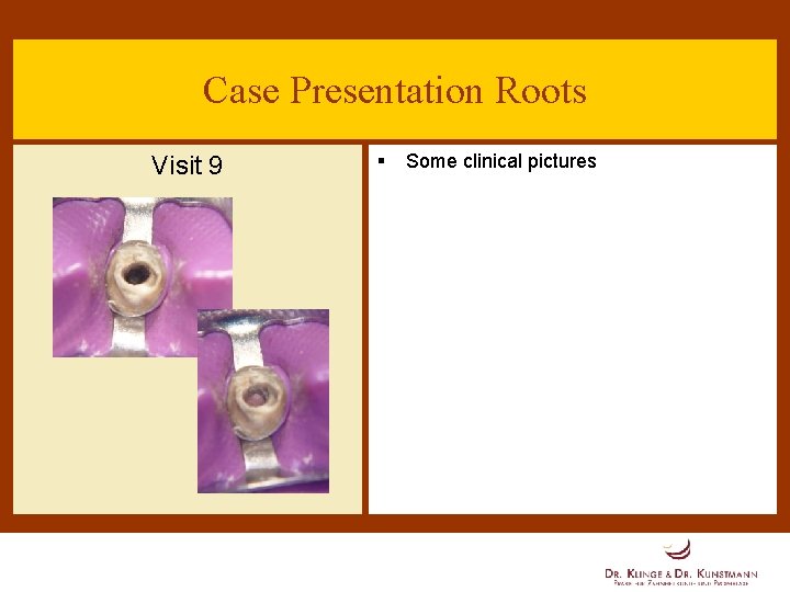 Case Presentation Roots Visit 9 § Some clinical pictures 