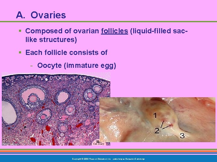 A. Ovaries § Composed of ovarian follicles (liquid-filled saclike structures) § Each follicle consists