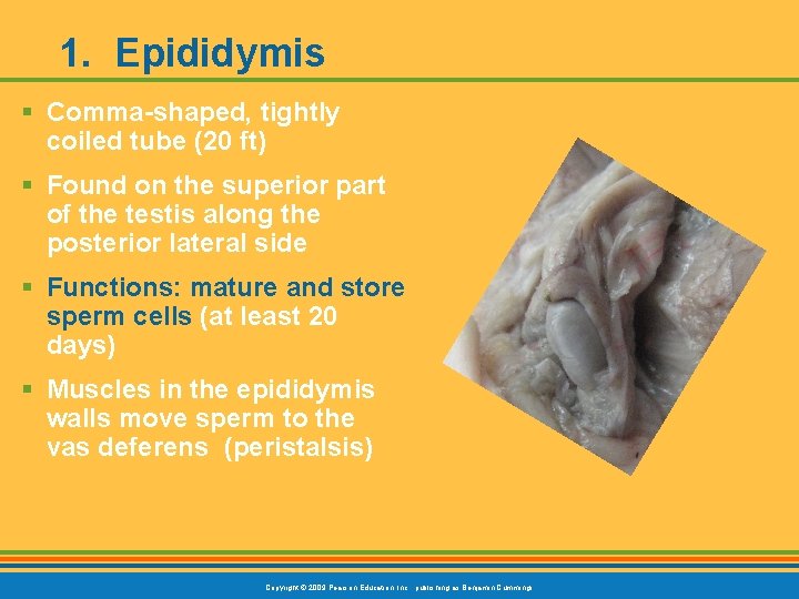 1. Epididymis § Comma-shaped, tightly coiled tube (20 ft) § Found on the superior