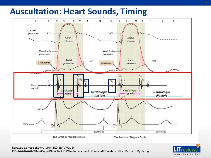 14 Auscultation: Heart Sounds, Timing http: //2. bp. blogspot. com/_uiyskj. NZYt 8/TJW 2 u.