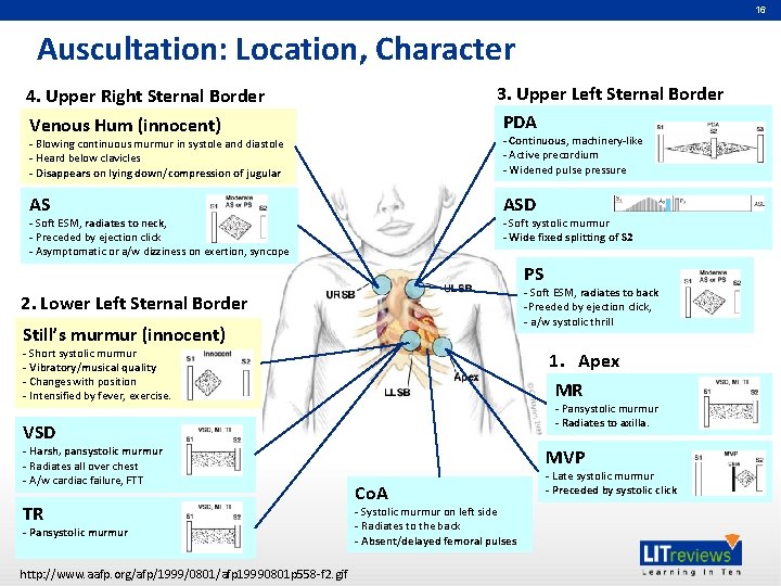 16 Auscultation: Location, Character 3. Upper Left Sternal Border PDA 4. Upper Right Sternal