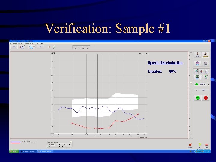 Verification: Sample #1 Speech Discrimination Unaided: 88% 