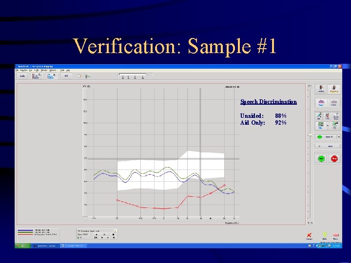 Verification: Sample #1 Speech Discrimination Unaided: Aid Only: 88% 92% 