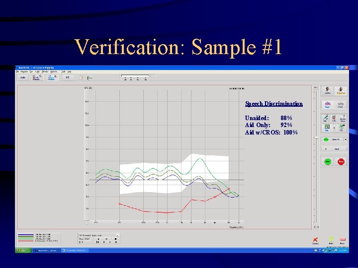 Verification: Sample #1 Speech Discrimination Unaided: 88% Aid Only: 92% Aid w/CROS: 100% 