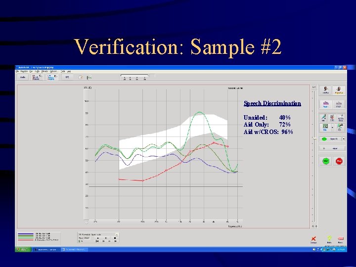 Verification: Sample #2 Speech Discrimination Unaided: 40% Aid Only: 72% Aid w/CROS: 96% 