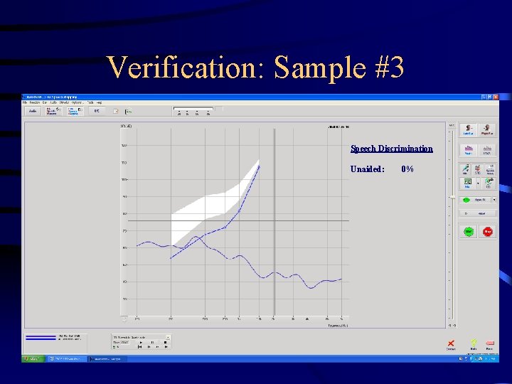 Verification: Sample #3 Speech Discrimination Unaided: 0% 