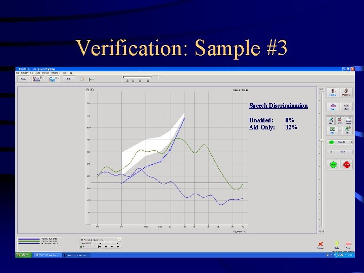 Verification: Sample #3 Speech Discrimination Unaided: Aid Only: 0% 32% 