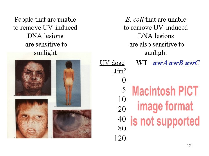 People that are unable to remove UV-induced DNA lesions are sensitive to sunlight E.