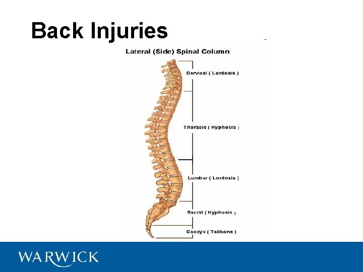 Back Injuries 