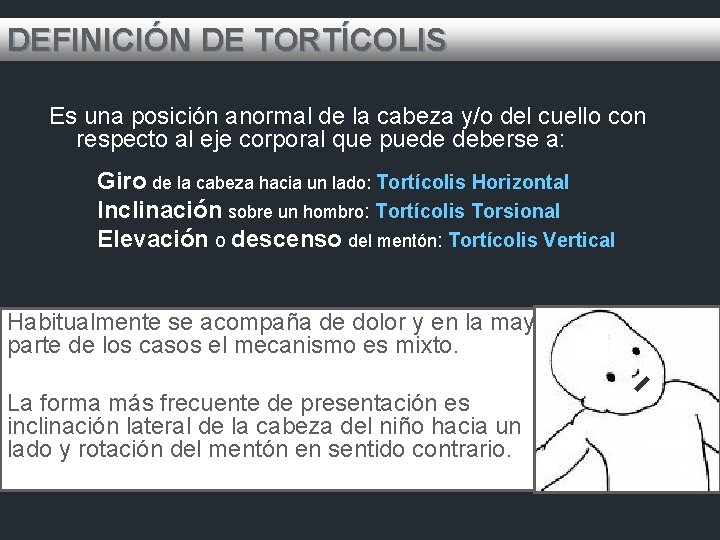 DEFINICIÓN DE TORTÍCOLIS Es una posición anormal de la cabeza y/o del cuello con