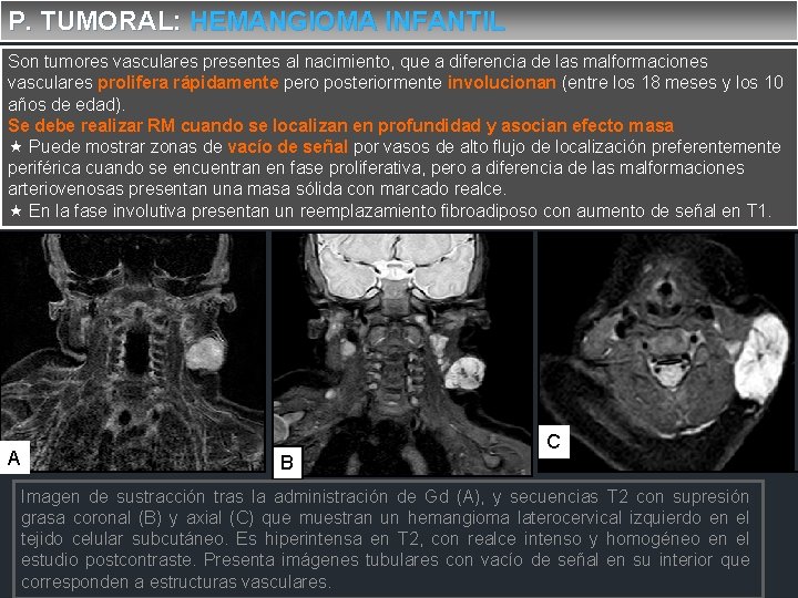 P. TUMORAL: HEMANGIOMA INFANTIL Son tumores vasculares presentes al nacimiento, que a diferencia de
