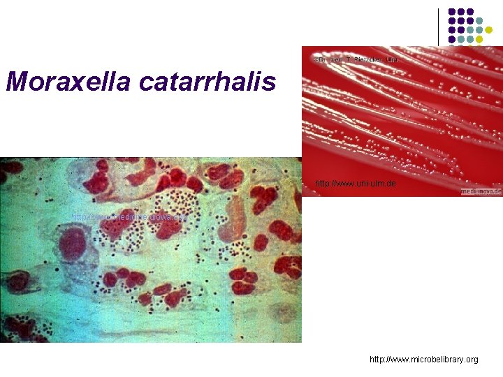 Moraxella catarrhalis http: //www. uni-ulm. de http: //www. medicine. uiowa. edu http: //www. microbelibrary.