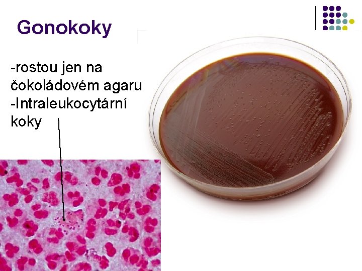 Gonokoky -rostou jen na čokoládovém agaru -Intraleukocytární koky 