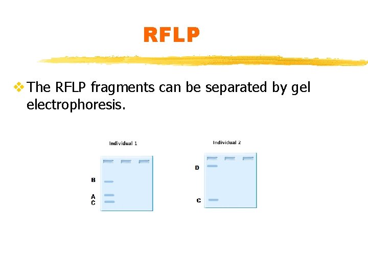 RFLP v The RFLP fragments can be separated by gel electrophoresis. 