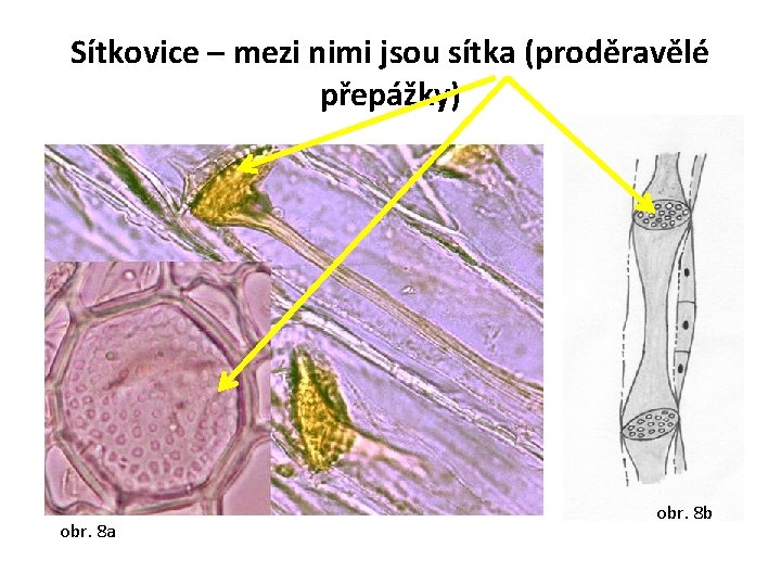 Sítkovice – mezi nimi jsou sítka (proděravělé přepážky) obr. 8 a obr. 8 b