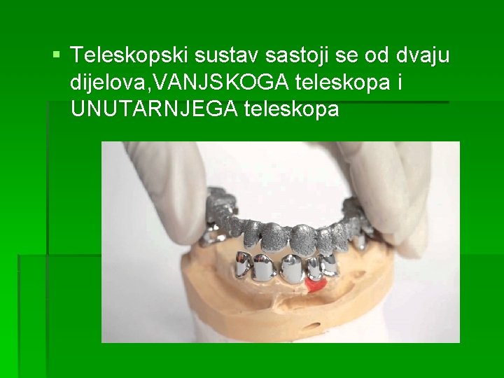 § Teleskopski sustav sastoji se od dvaju dijelova, VANJSKOGA teleskopa i UNUTARNJEGA teleskopa 