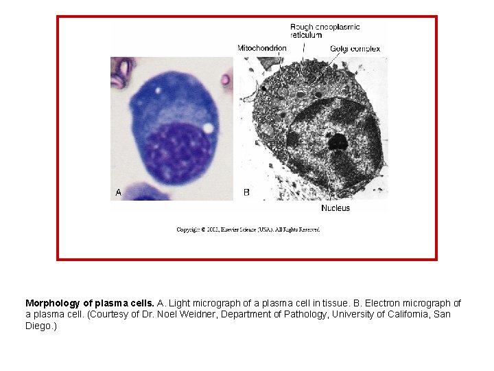 Morphology of plasma cells. A. Light micrograph of a plasma cell in tissue. B.