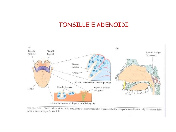 TONSILLE E ADENOIDI 