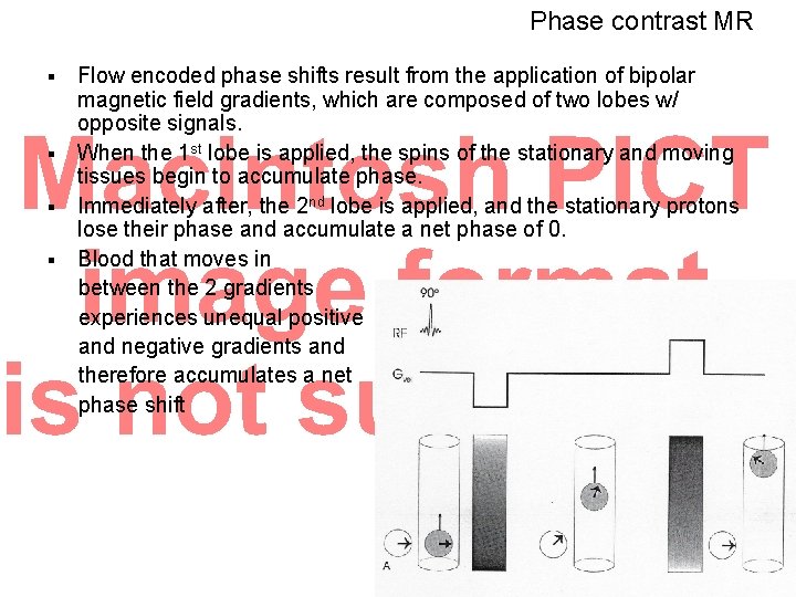 Phase contrast MR Flow encoded phase shifts result from the application of bipolar magnetic