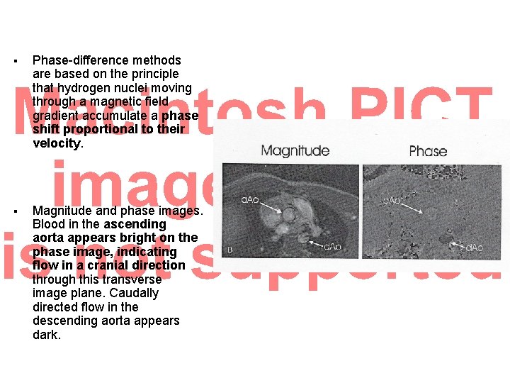 § Phase-difference methods are based on the principle that hydrogen nuclei moving through a § Phase-difference methods are based on the principle that hydrogen nuclei moving through a