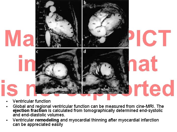 § § § Ventricular function Global and regional ventricular function can be measured from