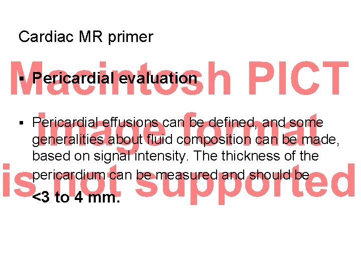 Cardiac MR primer § Pericardial evaluation § Pericardial effusions can be defined, and some