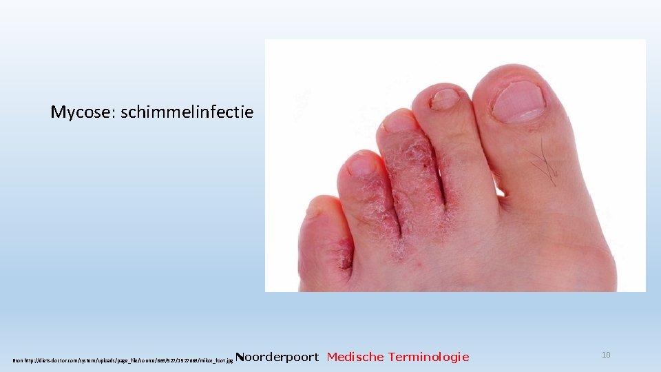 Mycose: schimmelinfectie Bron http: //diets-doctor. com/system/uploads/page_file/source/669/527/1527669/mikoz_foot. jpg Noorderpoort Medische Terminologie 10 