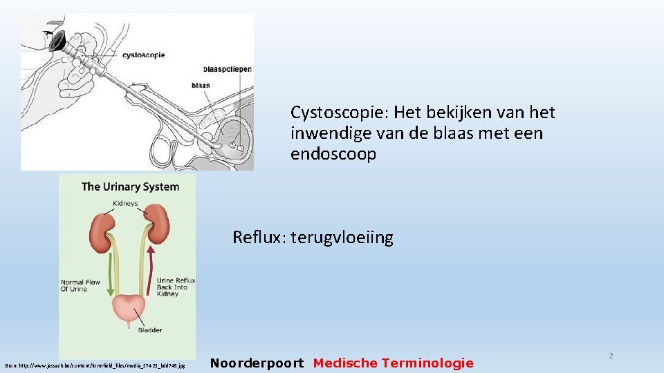 Cystoscopie: Het bekijken van het inwendige van de blaas met een endoscoop Reflux: terugvloeiing