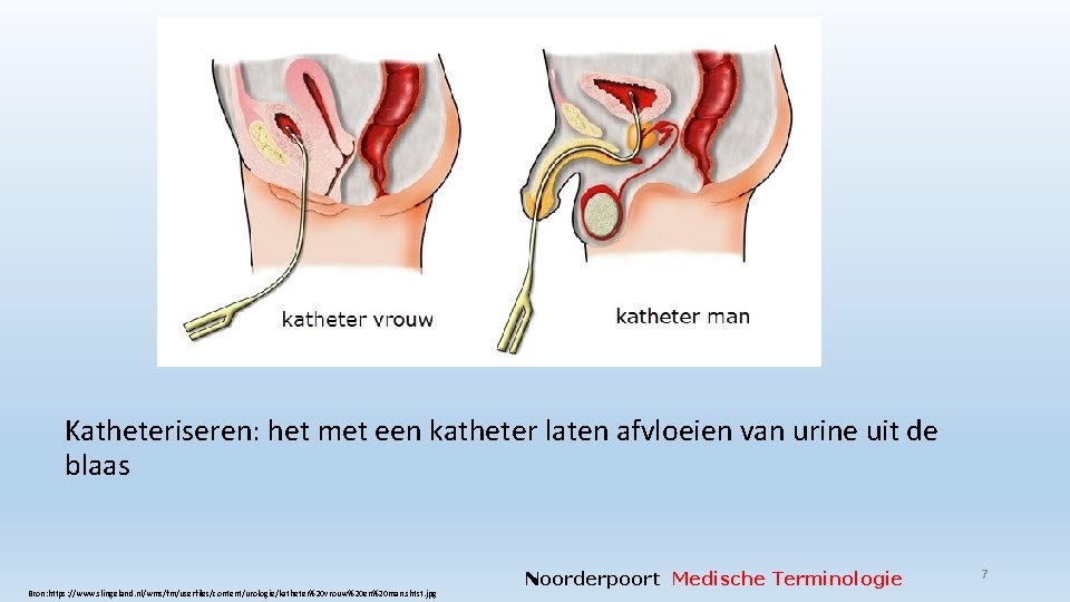 Katheteriseren: het met een katheter laten afvloeien van urine uit de blaas Bron: https: