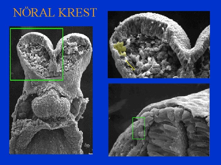 NÖRAL KREST 