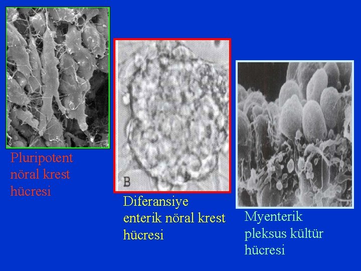 Pluripotent nöral krest hücresi Diferansiye enterik nöral krest hücresi Myenterik pleksus kültür hücresi 