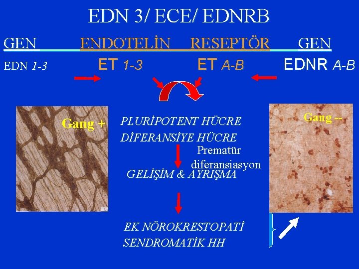 EDN 3/ ECE/ EDNRB GEN EDN 1 -3 ENDOTELİN ET 1 -3 Gang +