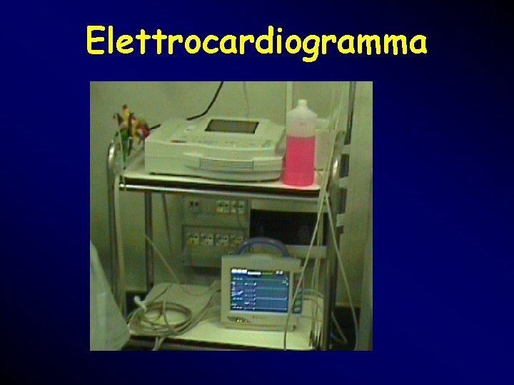 Elettrocardiogramma Elettrocardiogramma