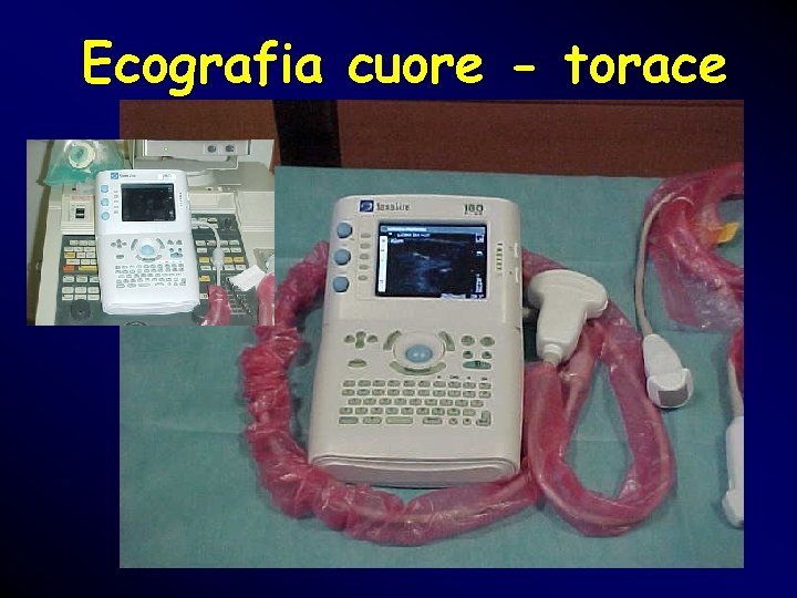 Ecografia cuore - torace Ecografia cuore - torace