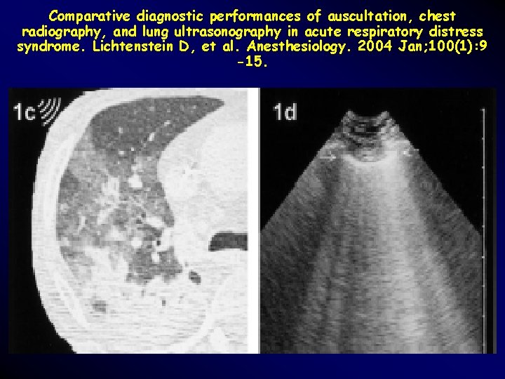 Comparative diagnostic performances of auscultation, chest radiography, and lung ultrasonography in acute respiratory distress Comparative diagnostic performances of auscultation, chest radiography, and lung ultrasonography in acute respiratory distress