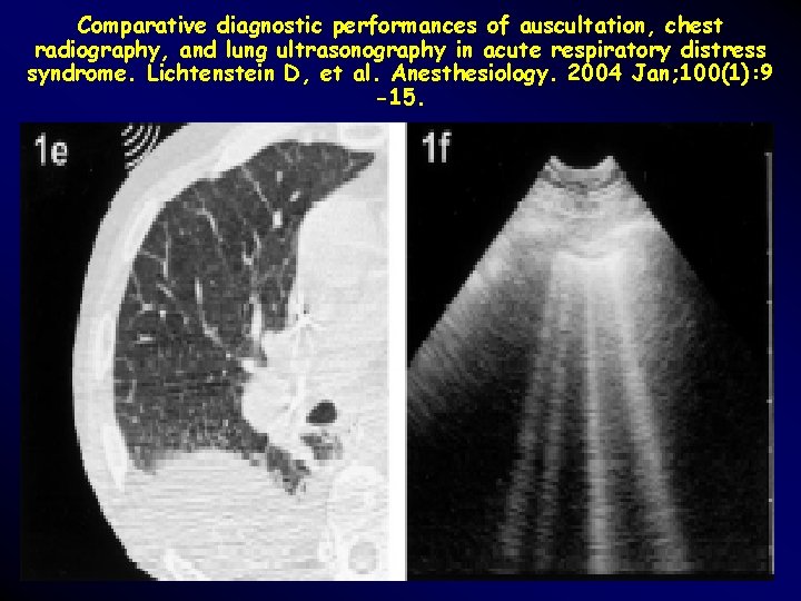 Comparative diagnostic performances of auscultation, chest radiography, and lung ultrasonography in acute respiratory distress Comparative diagnostic performances of auscultation, chest radiography, and lung ultrasonography in acute respiratory distress
