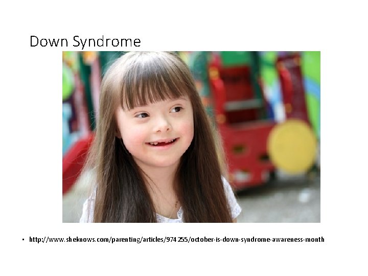 Down Syndrome • http: //www. sheknows. com/parenting/articles/974255/october-is-down-syndrome-awareness-month 