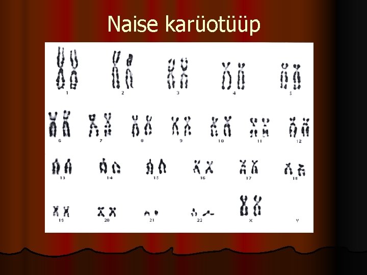 Naise karüotüüp 